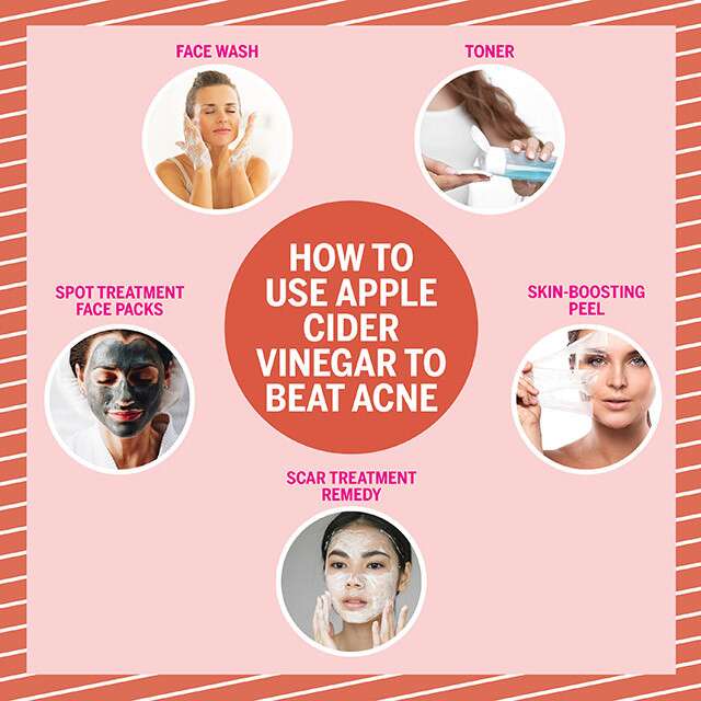 Proponents of apple cider vinegar believe that its acidity helps to balance the pH of the skin, reduce inflammation, and kill bacteria, all of which are important factors in treating acne. Additionally, apple cider vinegar contains vitamins and minerals that nourish the skin and promote healing.