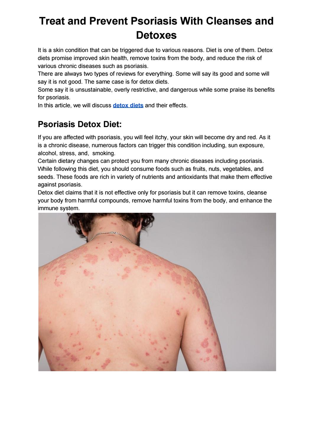 Instead of relying solely on dietary detoxes and cleanses, it's recommended that individuals with psoriasis work with a healthcare professional to develop a comprehensive treatment plan. This may include medications, topical treatments, light therapy, and lifestyle modifications such as stress reduction and a healthy diet. While dietary changes can be beneficial for overall health, they are unlikely to be a standalone solution for managing psoriasis.
